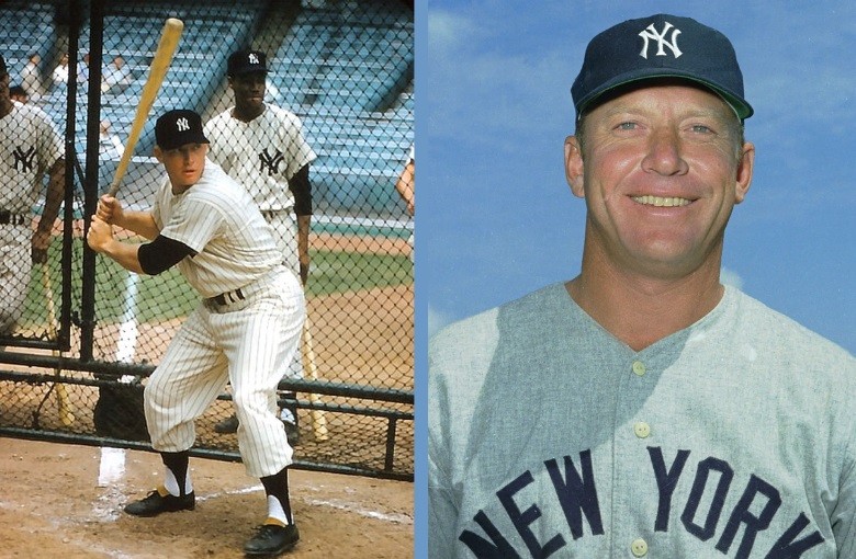 How Much Are Mickey Mantle Baseball Cards Worth Today Insights for Collectors